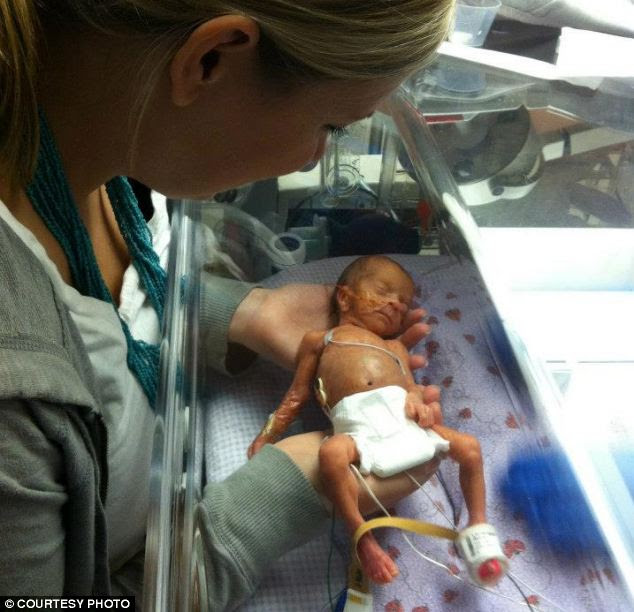 Premature Babies at 3 Pounds