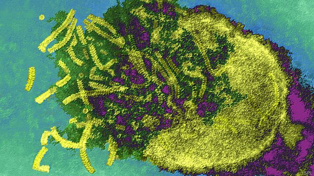 Virus del sarampión