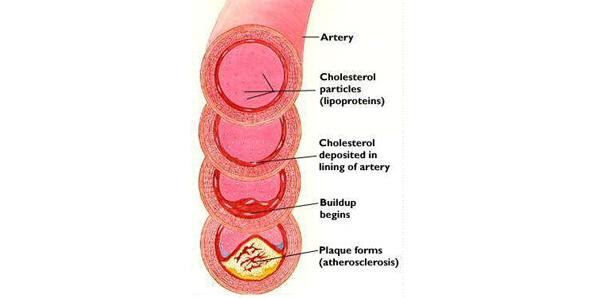 cholesterol levels