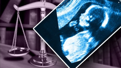abortion graphic