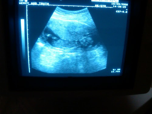 Mark Jr.! - approximately 15 weeks