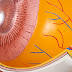Central Serous Retinopathy Forum : Check spelling or type a new query.