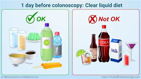  pin on you and colonoscopy