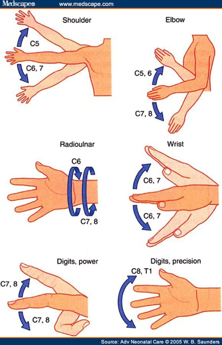 Spinal nerve root origin of upper extremity movements.