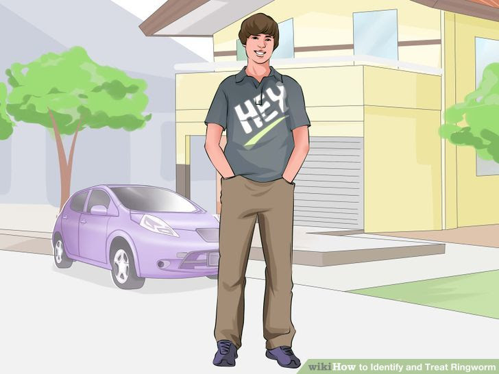 Identify and Treat Ringworm Step 22.jpg