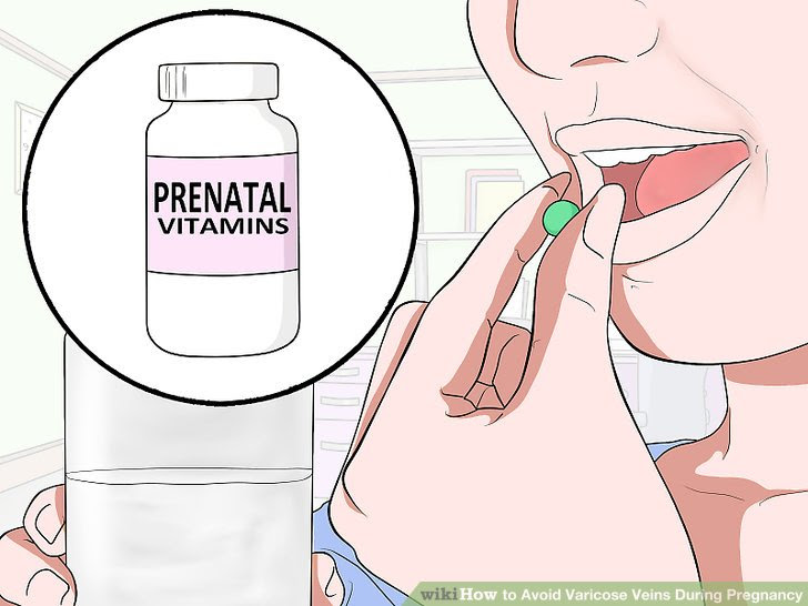 Avoid Varicose Veins During Pregnancy Step 12 Version 2.jpg