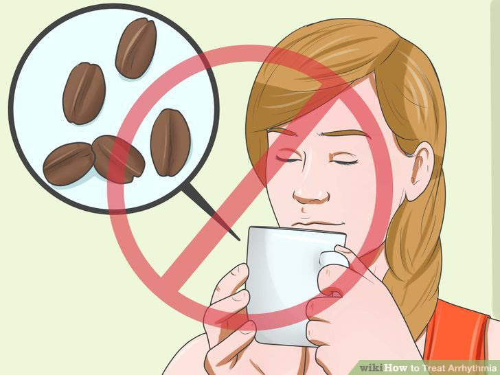 Treat Arrhythmia Step 7 Version 2.jpg