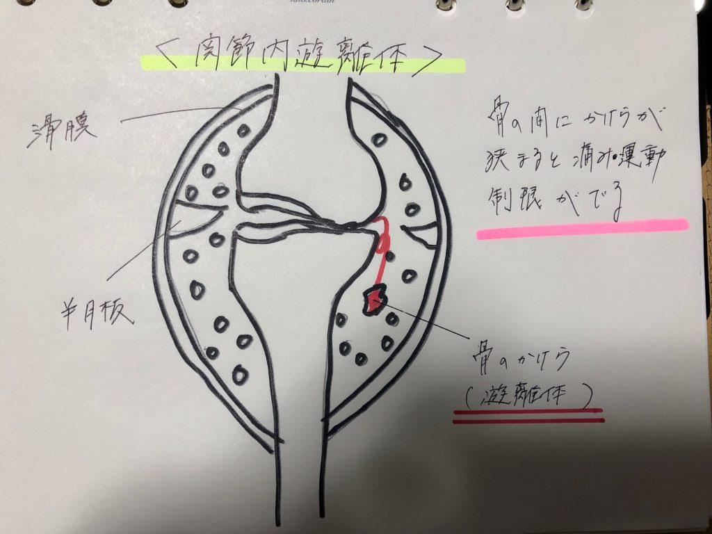 変形性膝関節症 Ca鍼灸整骨院