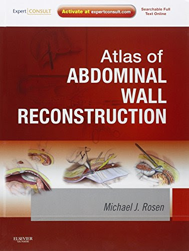 Atlas of Abdominal Wall Reconstruction: Expert Consult - Online and Print