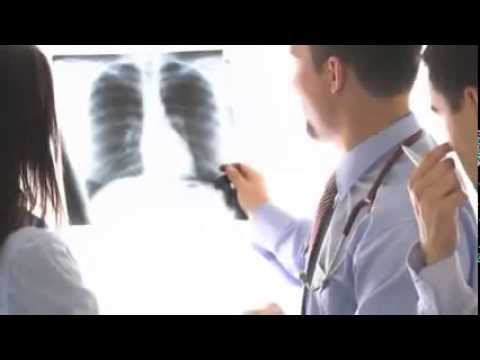 Harga Mesothelioma Staging