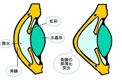 病気の話 杉並区医師会