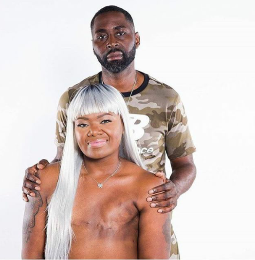 Man poses with his topless wife and breast cancer survivor