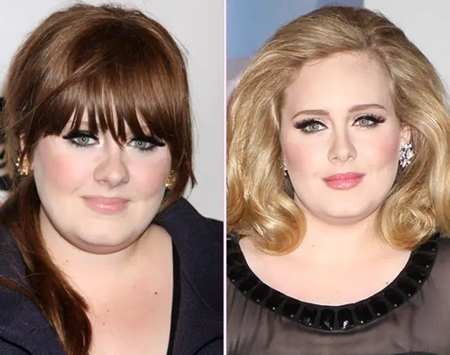 Adele Nose Job Plastic Surgery Before and After | Celebie