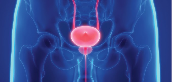 Prostate Cancer Treatment Karachi / Button TURP vs. Green Light Laser for Benign Prostatic