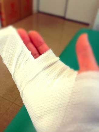 ちくちくハンドメイド One 右小指中節骨剥離骨折