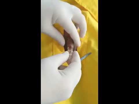Terlengkap Cara Pasang Alisklamp Screw I Alisklamp Terbaru, Terbaru!