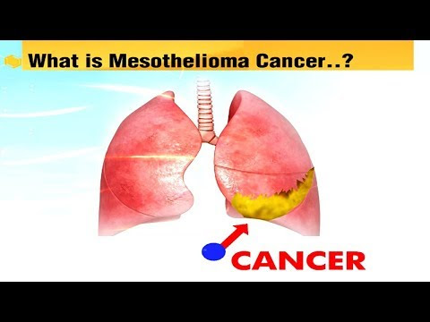 VIDEO : what is mesothelioma cancer | mesothelioma claims | mesothelioma lawyer | mesothelioma claims center - what is mesothelioma cancer | mesothelioma claims |what is mesothelioma cancer | mesothelioma claims |mesothelioma lawyer| meso ...