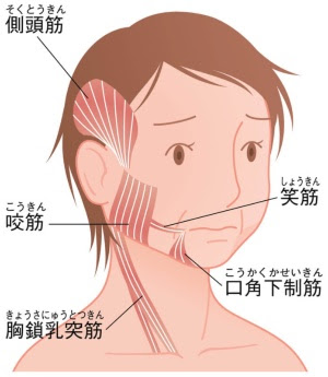 頬のたるみやほうれい線 エラ張りの原因が食いしばり ブログ