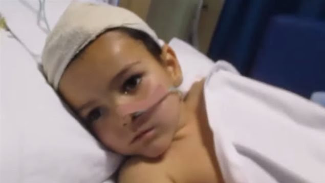 most cancers du cerveau symptomes bébé