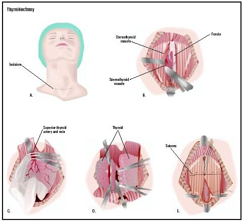 The veins and arteries 