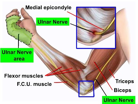 Cubital Tunnel Syndrome