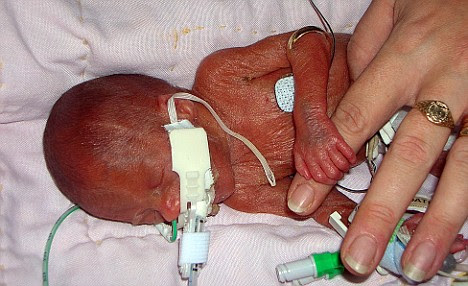 Abortion At 24 Weeks Is Murder The Student Room