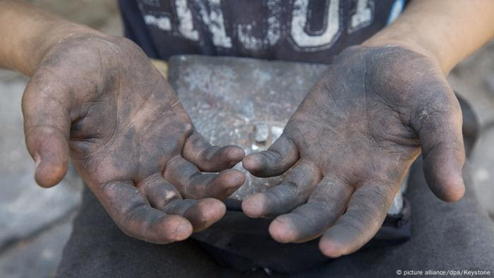 Resultado de imagem para Acidentes de trabalho vitimam mais de 40 mil crianÃ§as e adolescentes em dez anos