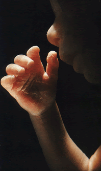 Αγέννητο παιδί