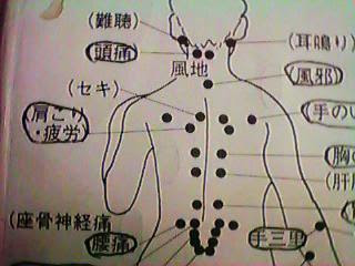 電子温熱灸