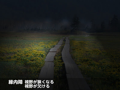 目の病気 症状 緑内障などの悩み症状はメディコへ 目の病気や悩み相談 緑内障