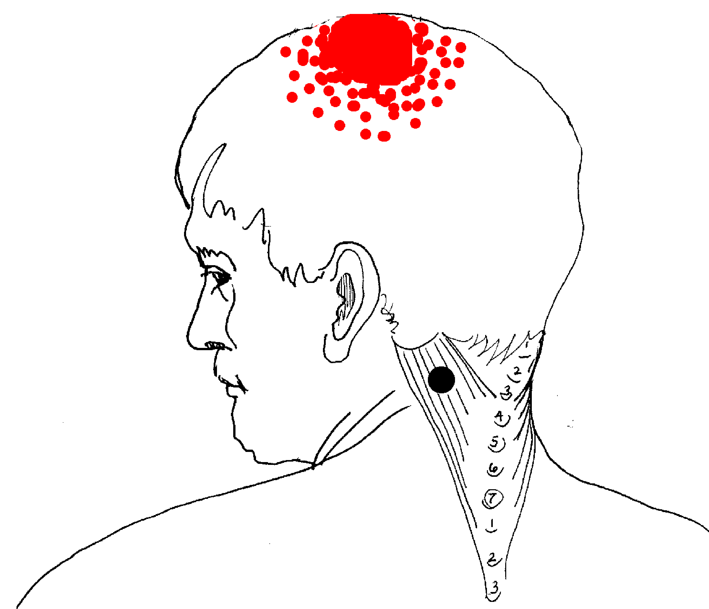 Round Earth Publishing Introduction To Head Pain
