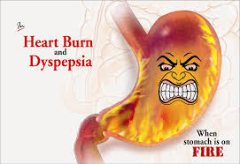 Got Heartburn? How to Know If It's Acid Reflux or a Hiatal ...