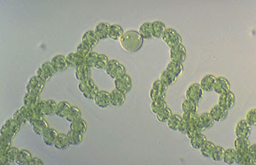 Image result for Anabaena flos-aquae