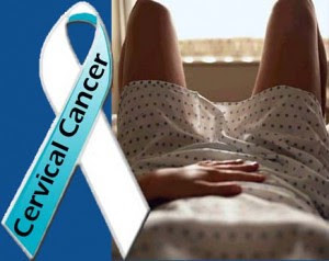 Cervical cancer symptoms