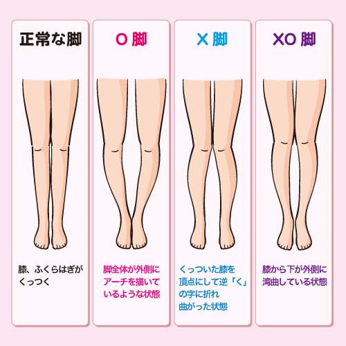 靴の外側がすり減る人 筋膜整体 高知市のアスリート マッサージ師も通う 肩こり 腰痛 ひざ痛 骨盤矯正なら 爽心 そうしん グループ