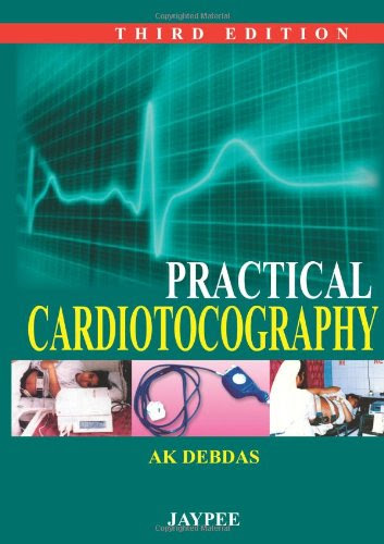 Practical CardiotocographyBy A. K ., M.D. Debdas