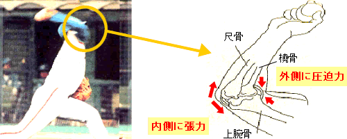 野球肘のリハビリテーション 医療法人はぁとふる 運動器ケア しまだ病院