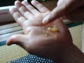 【ベストコレクション】 ��ダカ 卵 白い膜 152119-メダ��� 卵 白い膜
