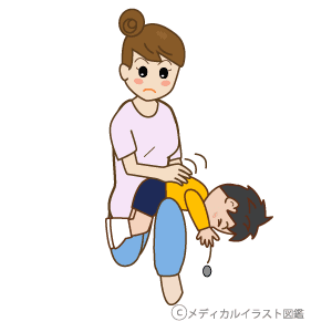 大きな子供の背部叩打法 メディカルイラスト図鑑 無料の医療 美容素材集