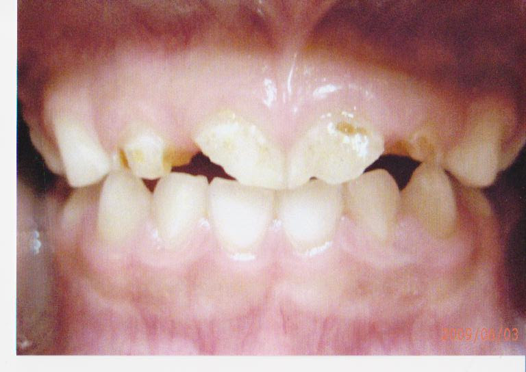 院長ブログ 城内歯科医院