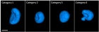 Epithelial-Cells