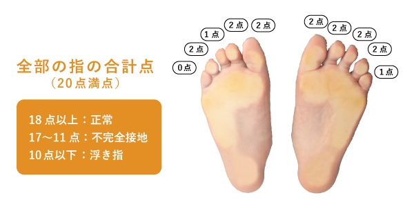 浮き指かも と思ったら その正しい理解と対策 足のお悩み百科