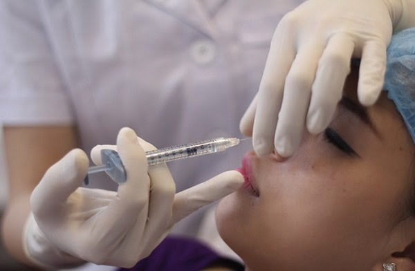 Hỏi đáp về nâng mũi không phẫu thuật có đau không