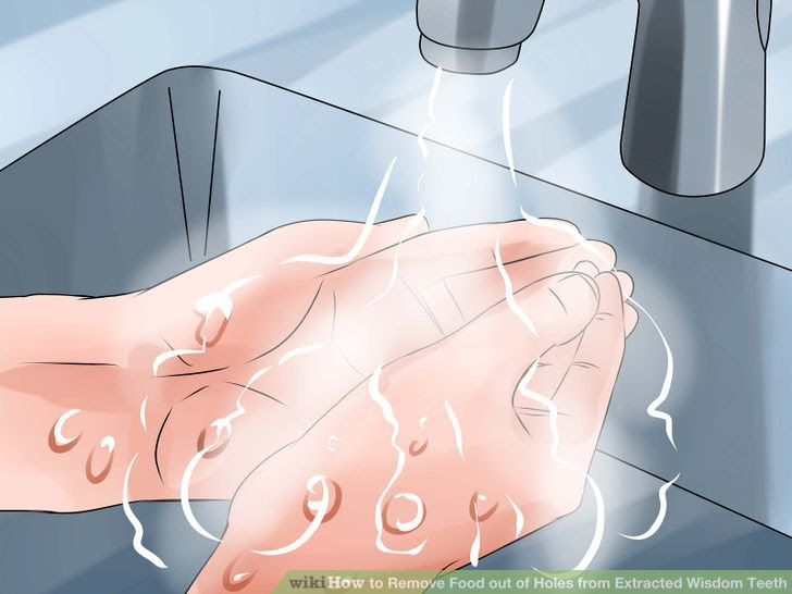 Remove Food out of Holes from Extracted Wisdom Teeth Step 13.jpg