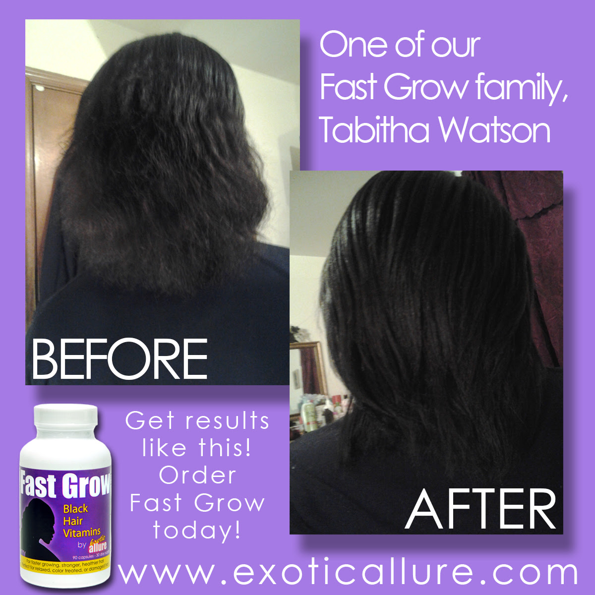 Fast Grow Vitamins for Hair Growth for African American ...