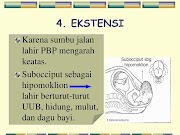 Inspirasi 38+ Sumbu Jalan Lahir