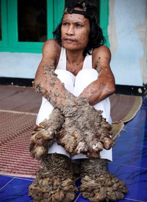 tree man dede 2010. Dede+koswara+2011