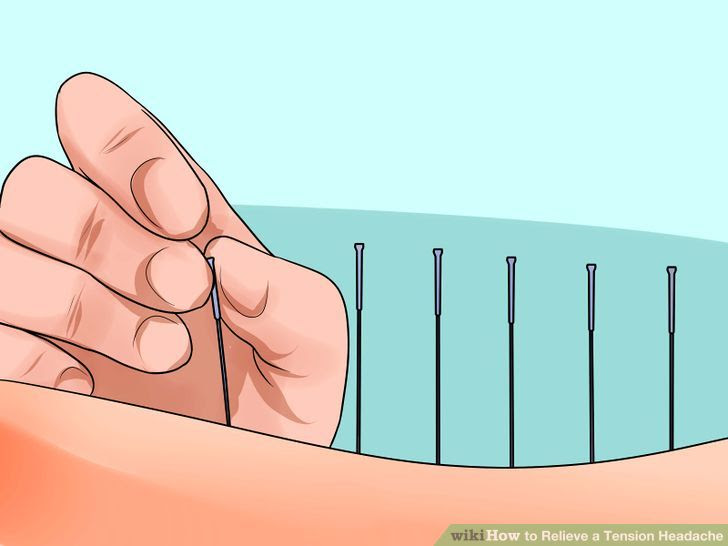Relieve a Tension Headache Step 3 Version 2.jpg