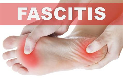 Como todos pisamos un poco diferente, la fascia plantar sufre por distintas causas en los diferentes patrones mecánicos. âRemedios caseros para la fascitis plantar o talÃ³n del