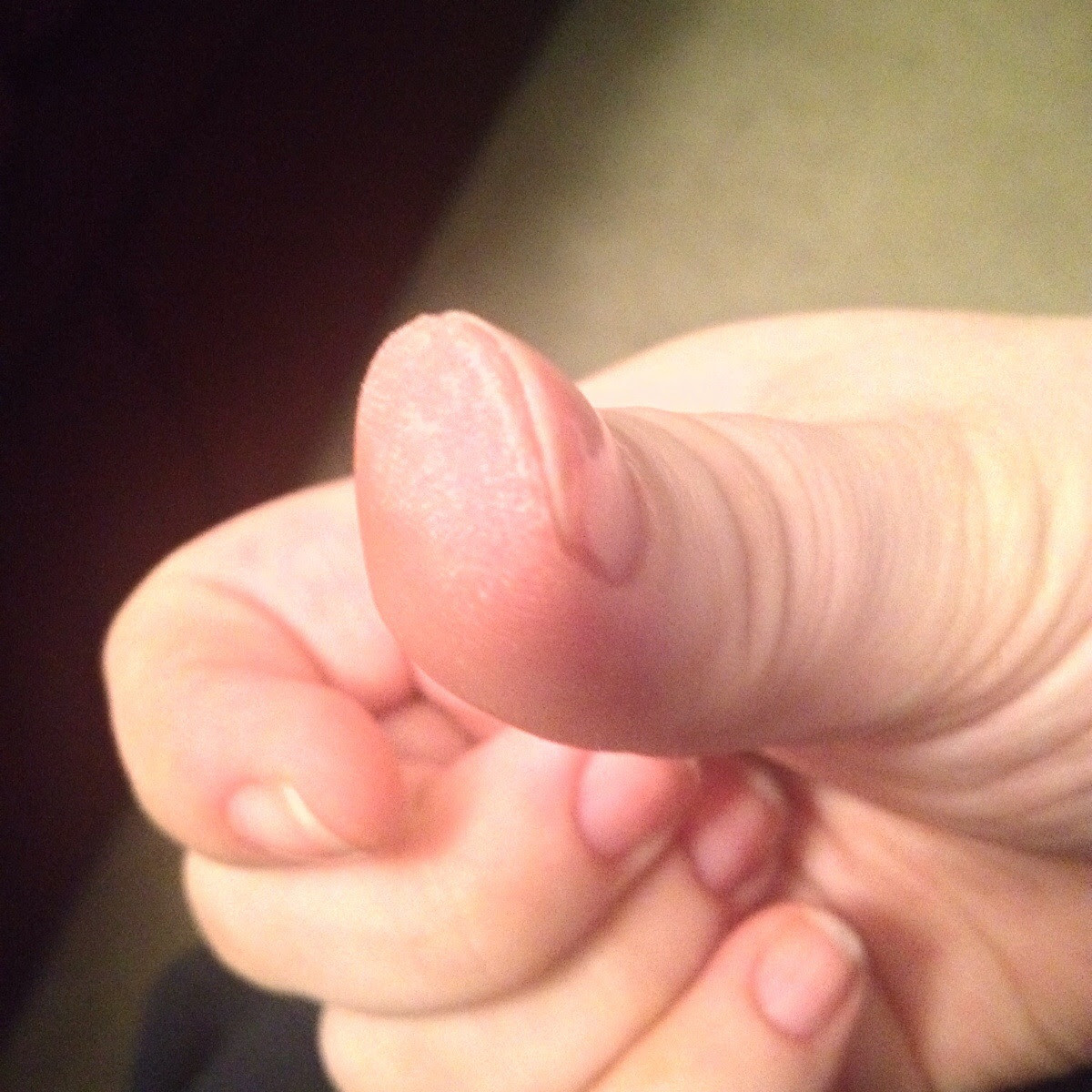 I Get Terrible Dry Flakey Skin Under My Nails At The Tips Of My Fingers I Moisturize And Exfoliate Like Crazy But Nothing Helps I Really Need Some Suggestions Here Because I Find
